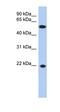 Crystallin Gamma C antibody, orb325734, Biorbyt, Western Blot image 