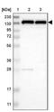 Ubiquitination Factor E4B antibody, NBP1-84943, Novus Biologicals, Western Blot image 