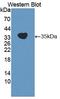 Cyclin Dependent Kinase 20 antibody, LS-C663477, Lifespan Biosciences, Western Blot image 