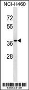 CutC Copper Transporter antibody, 58-743, ProSci, Western Blot image 