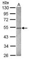 Zinc Finger Protein 213 antibody, NBP2-20976, Novus Biologicals, Western Blot image 