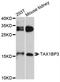 Tax1 Binding Protein 3 antibody, A8750, ABclonal Technology, Western Blot image 