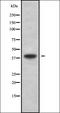 Galactose Mutarotase antibody, orb337987, Biorbyt, Western Blot image 