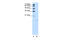 Acid Phosphatase 1 antibody, 29-710, ProSci, Western Blot image 