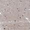 Presenilin 1 antibody, NBP1-90245, Novus Biologicals, Immunohistochemistry paraffin image 