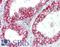 Claudin 4 antibody, LS-B8382, Lifespan Biosciences, Immunohistochemistry paraffin image 