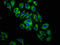 Integrin Subunit Beta 6 antibody, LS-C670495, Lifespan Biosciences, Immunofluorescence image 