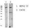 Large Tumor Suppressor Kinase 1 antibody, STJ99623, St John
