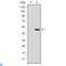 Troponin I2, Fast Skeletal Type antibody, LS-C812791, Lifespan Biosciences, Western Blot image 