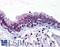 Telomerase Reverse Transcriptase antibody, LS-B95, Lifespan Biosciences, Immunohistochemistry paraffin image 