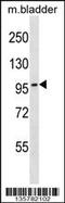 DNA Topoisomerase III Beta antibody, 58-713, ProSci, Western Blot image 