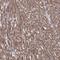 Inositol Polyphosphate Multikinase antibody, NBP1-89426, Novus Biologicals, Immunohistochemistry frozen image 