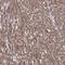 Inositol polyphosphate multikinase antibody, NBP1-89426, Novus Biologicals, Immunohistochemistry frozen image 