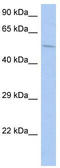 Calcium/calmodulin-dependent 3 ,5 -cyclic nucleotide phosphodiesterase 1B antibody, TA330413, Origene, Western Blot image 