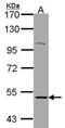 Cholinergic Receptor Nicotinic Alpha 3 Subunit antibody, PA5-28258, Invitrogen Antibodies, Western Blot image 