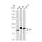 Fragile Histidine Triad Diadenosine Triphosphatase antibody, GTX02837, GeneTex, Western Blot image 