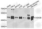 Glycogen Synthase Kinase 3 Beta antibody, A0480, ABclonal Technology, Western Blot image 