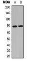 Ezrin antibody, LS-C368425, Lifespan Biosciences, Western Blot image 
