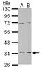 Geranylgeranyl Diphosphate Synthase 1 antibody, GTX106493, GeneTex, Western Blot image 