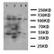 Phospholipase A2 Group IVA antibody, orb99209, Biorbyt, Western Blot image 