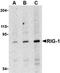 Sodium Channel Epithelial 1 Beta Subunit antibody, orb4660, Biorbyt, Western Blot image 
