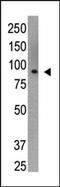 Cbl Proto-Oncogene C antibody, AP11261PU-N, Origene, Western Blot image 