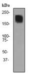 Neural Cell Adhesion Molecule 1 antibody, ab75813, Abcam, Western Blot image 