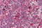 FGR Proto-Oncogene, Src Family Tyrosine Kinase antibody, MBS245992, MyBioSource, Immunohistochemistry paraffin image 