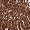 Cartilage Associated Protein antibody, PA5-60630, Invitrogen Antibodies, Immunohistochemistry paraffin image 