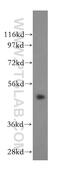Cleavage Stimulation Factor Subunit 1 antibody, 15537-1-AP, Proteintech Group, Western Blot image 