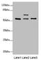 Endoplasmic Reticulum Oxidoreductase 1 Alpha antibody, LS-C675726, Lifespan Biosciences, Western Blot image 