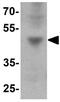 Interferon Induced Protein With Tetratricopeptide Repeats 3 antibody, GTX31919, GeneTex, Western Blot image 