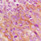 Eukaryotic Translation Initiation Factor 2 Alpha Kinase 2 antibody, LS-C352730, Lifespan Biosciences, Immunohistochemistry frozen image 