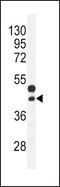 Cellular Communication Network Factor 2 antibody, GTX81297, GeneTex, Western Blot image 