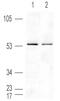 Peroxisome Proliferator Activated Receptor Delta antibody, ab8937, Abcam, Western Blot image 