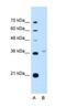 Peroxisomal Biogenesis Factor 3 antibody, NBP1-52960, Novus Biologicals, Western Blot image 