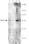 Transient Receptor Potential Cation Channel Subfamily V Member 6 antibody, NBP1-74138, Novus Biologicals, Western Blot image 
