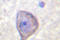Fms Related Tyrosine Kinase 1 antibody, LS-C176480, Lifespan Biosciences, Immunohistochemistry frozen image 