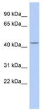 Gamma-Aminobutyric Acid Type A Receptor Beta1 Subunit antibody, TA338506, Origene, Western Blot image 