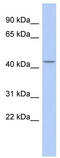 Gamma-Aminobutyric Acid Type A Receptor Beta1 Subunit antibody, TA338506, Origene, Western Blot image 