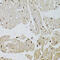 Fibroblast Growth Factor 2 antibody, 13-095, ProSci, Immunohistochemistry paraffin image 