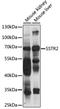 Somatostatin Receptor 2 antibody, LS-C750072, Lifespan Biosciences, Western Blot image 