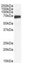 Neurofilament Medium antibody, 42-197, ProSci, Western Blot image 