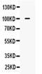 Cast antibody, PA5-78925, Invitrogen Antibodies, Western Blot image 