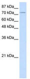 Zinc Finger Protein 441 antibody, TA331626, Origene, Western Blot image 