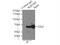 Sequestosome 1 antibody, 18420-1-AP, Proteintech Group, Immunoprecipitation image 