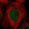 UTP23 Small Subunit Processome Component antibody, NBP1-92568, Novus Biologicals, Immunofluorescence image 