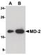 Lymphocyte Antigen 96 antibody, MA5-15766, Invitrogen Antibodies, Western Blot image 