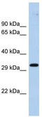 Zinc Finger Protein 397 antibody, TA342428, Origene, Western Blot image 