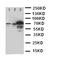 Solute Carrier Family 6 Member 4 antibody, orb76219, Biorbyt, Western Blot image 
